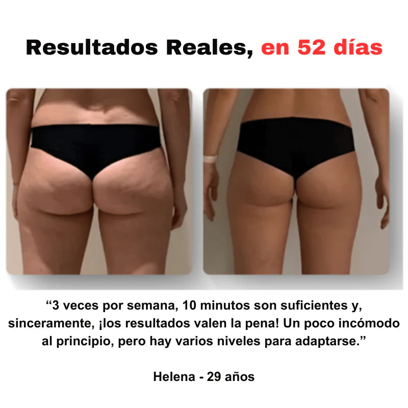 CelluStop™ – Masajeador Anticelulitis